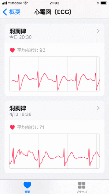 アップルウォッチで測定した心電図波形はアイフォンの『ヘルスケア』アプリに自動的に保存されます